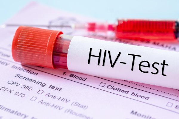 Bezpłatne testowanie w kierunku HIV w Gdyni